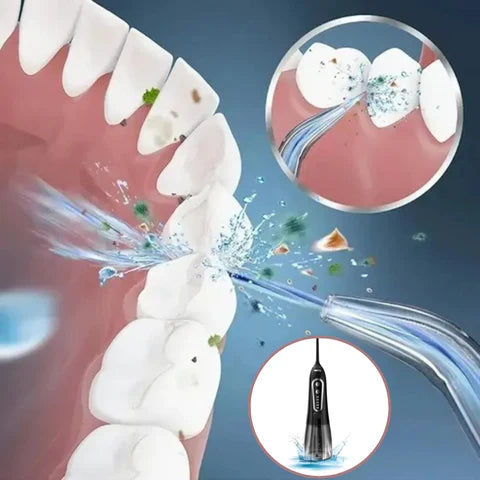 Portable Oral Irrigator - OralJet