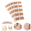 Kit of 100 Ingrown Toenail Correction Patches