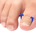 Kit of 100 Ingrown Toenail Correction Patches