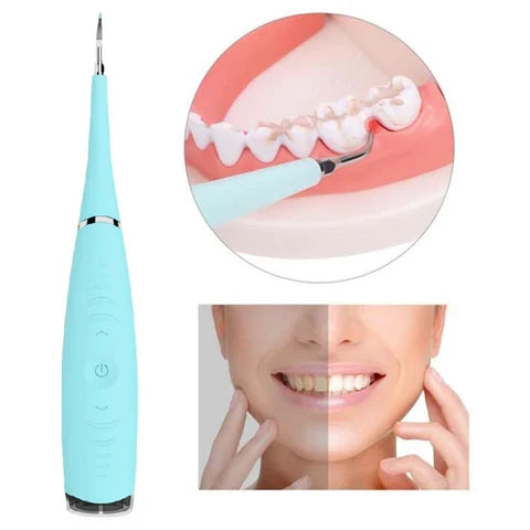 Dental Tartar and Plaque Remover