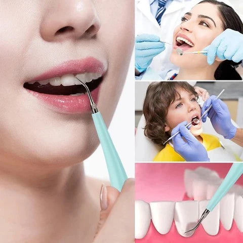 Dental Tartar and Plaque Remover